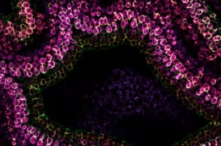 organoid